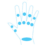Articulaciones de la mano afectadas en la artritis